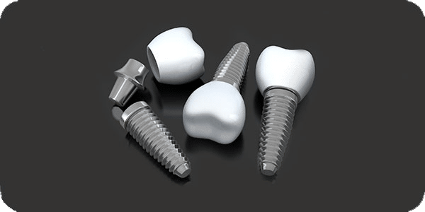 Dental Implants Image